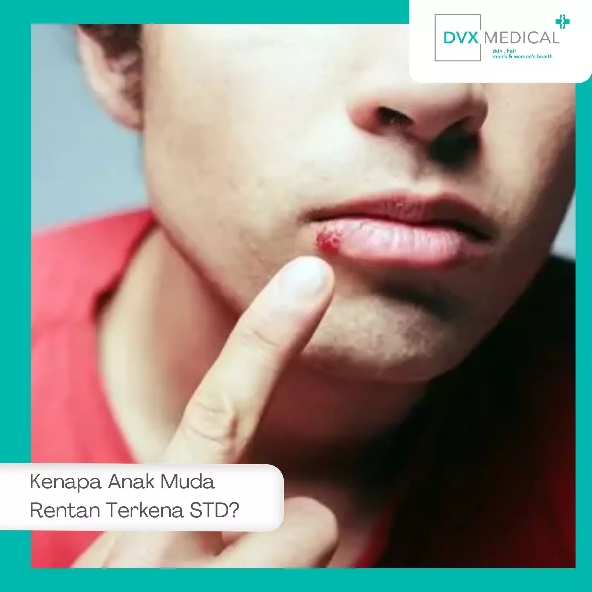 Kenapa Anak Muda Rentan Terkena STD?