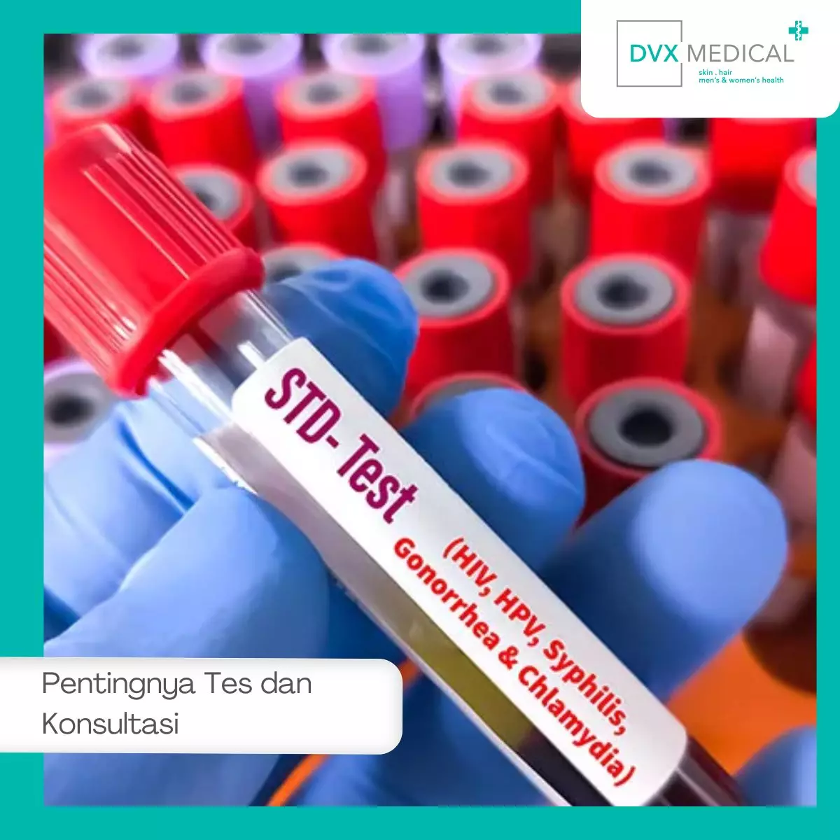 Pentingnya Tes dan Konsultasi