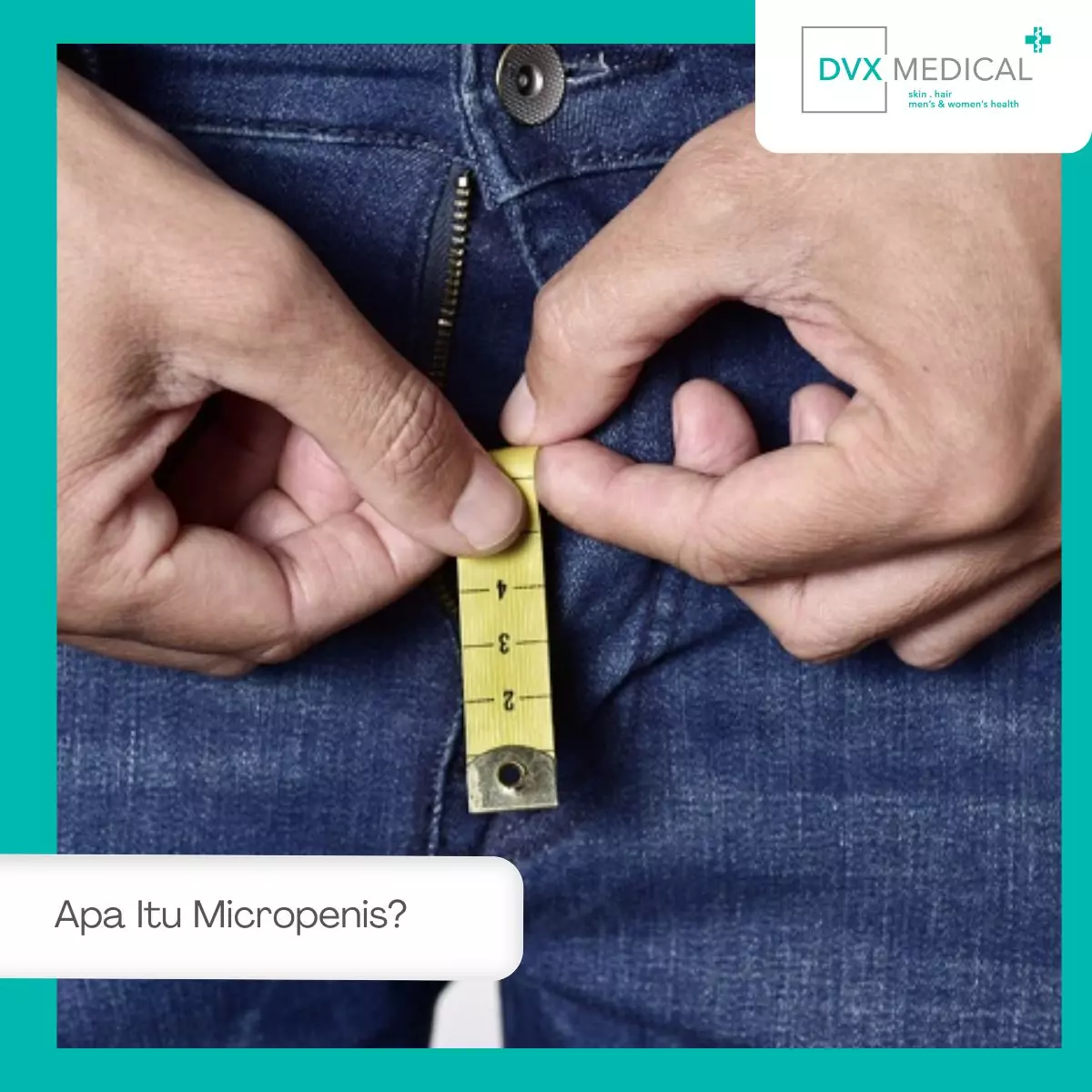 Apa Itu Micropenis?
