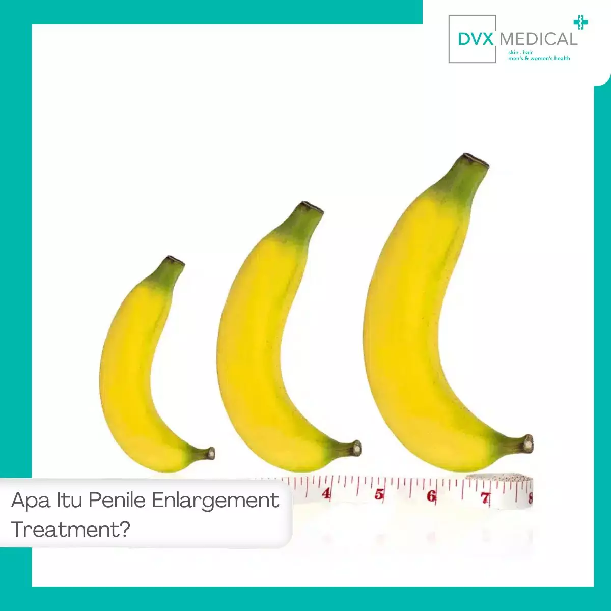 Apa Itu Penile Enlargement Treatment?