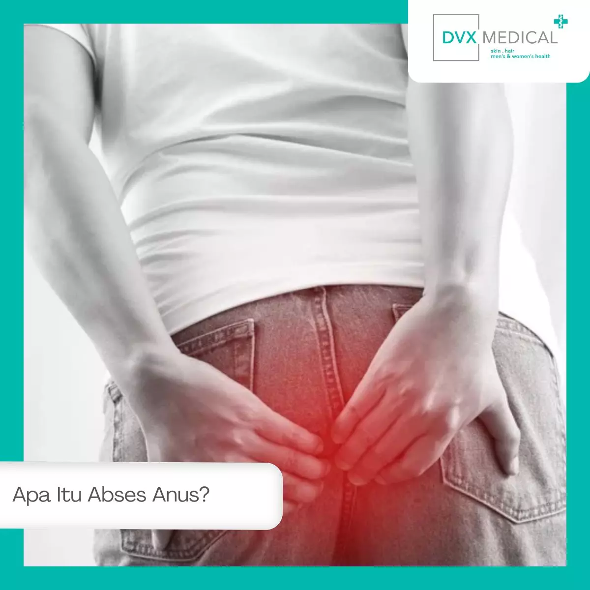 Apa Itu Abses Anus?