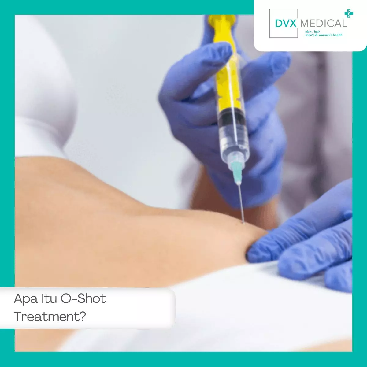 Apa Itu O-Shot Treatment?