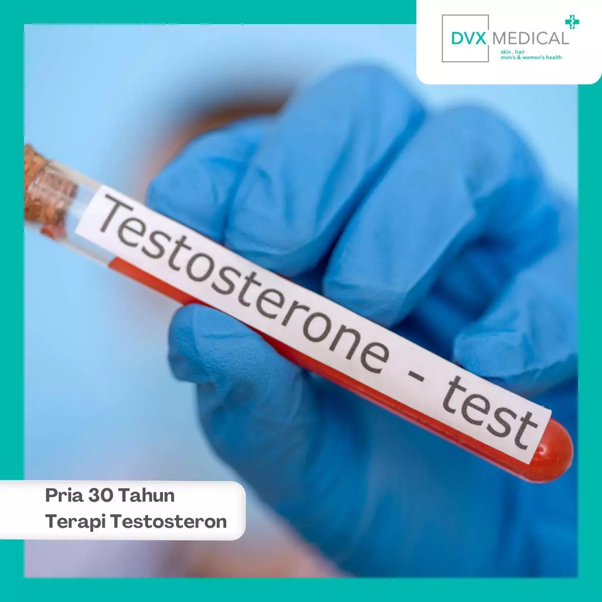Apa Itu Terapi Testosteron Pria?