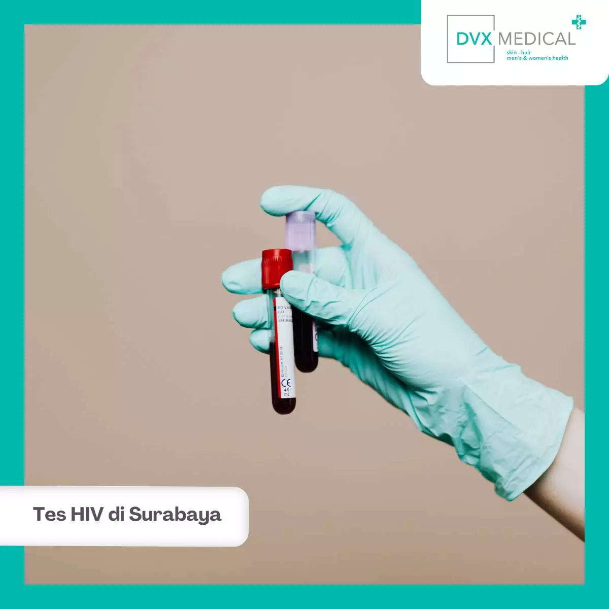 Proses Pemeriksaan dan Pengobatan HIV di DVX Medical Surabaya