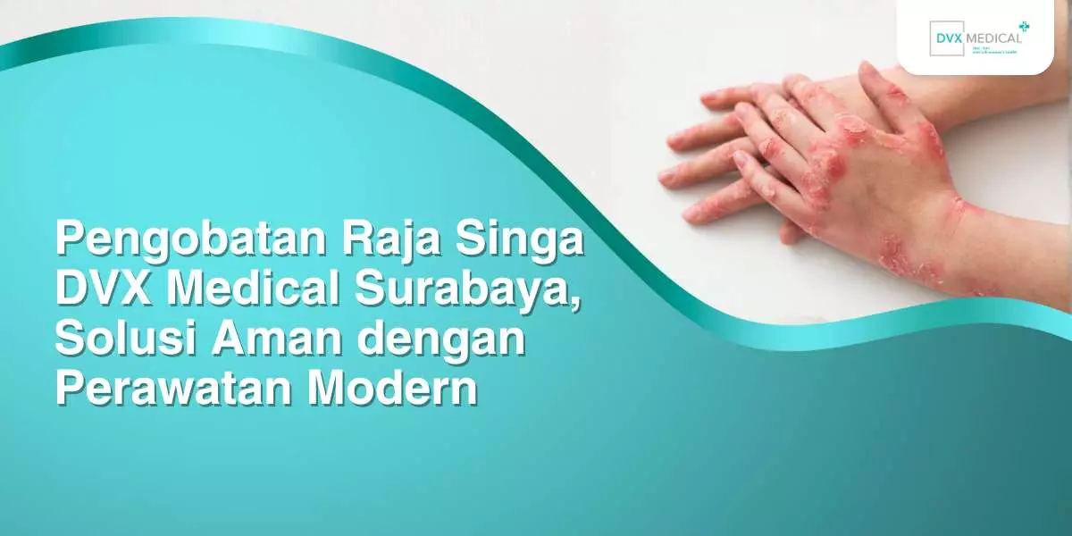 Pengobatan Raja Singa Dvx Medical Surabaya Solusi Aman Dengan Perawatan Modern