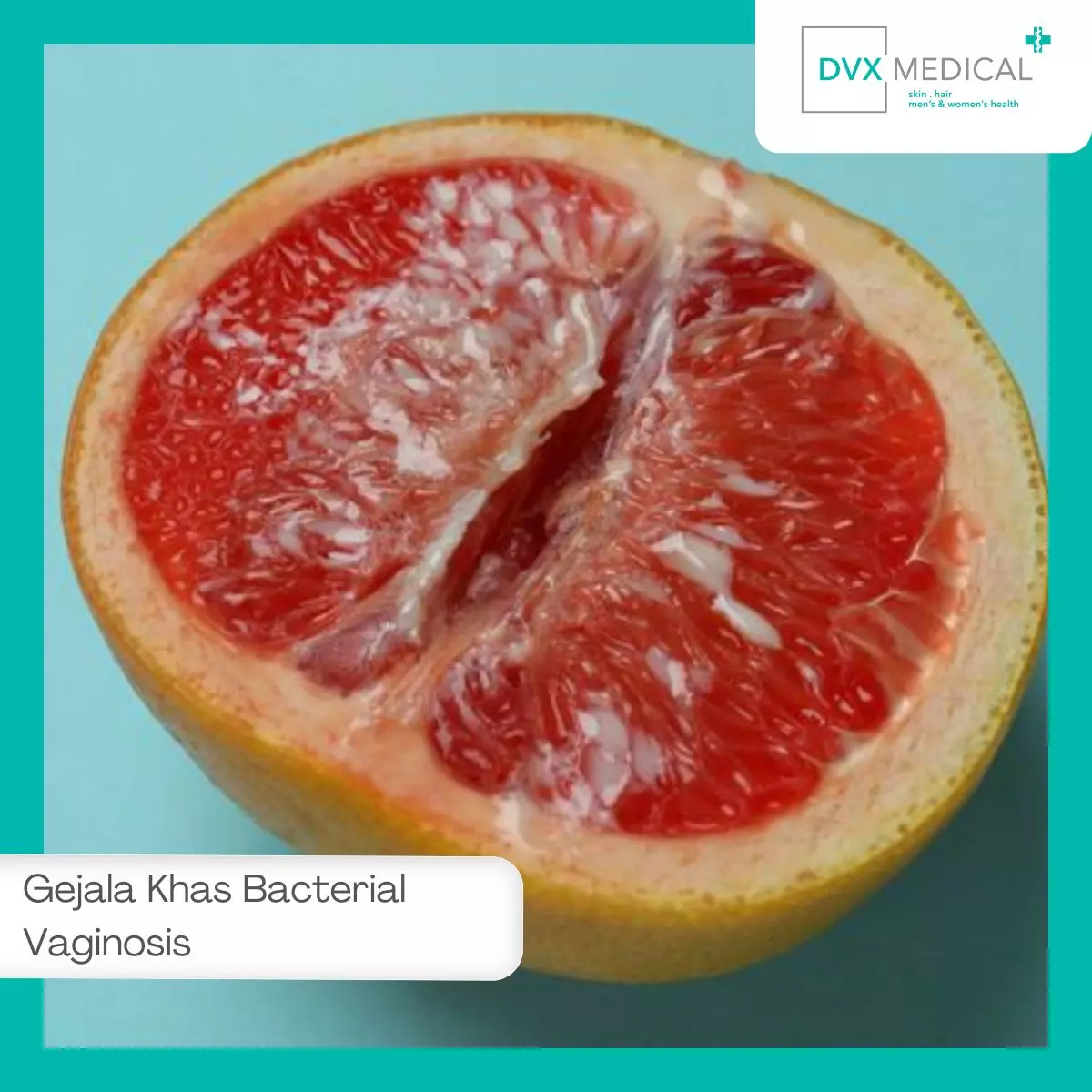 Gejala Khas Bacterial Vaginosis