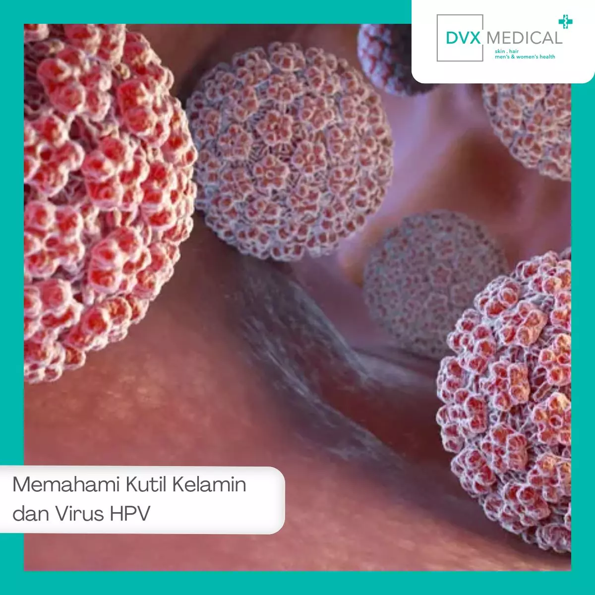 Memahami Kutil Kelamin dan Virus HPV