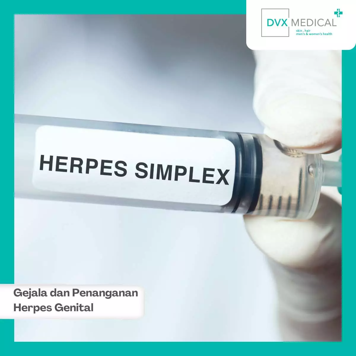 Cara Penanganan dan Pengobatan Herpes Genital