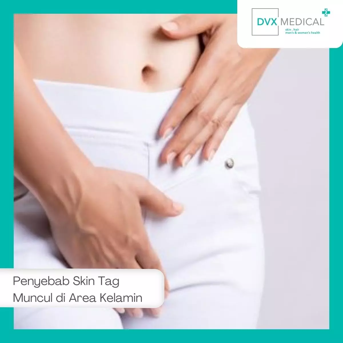Penyebab Skin Tag Muncul di Area Kelamin