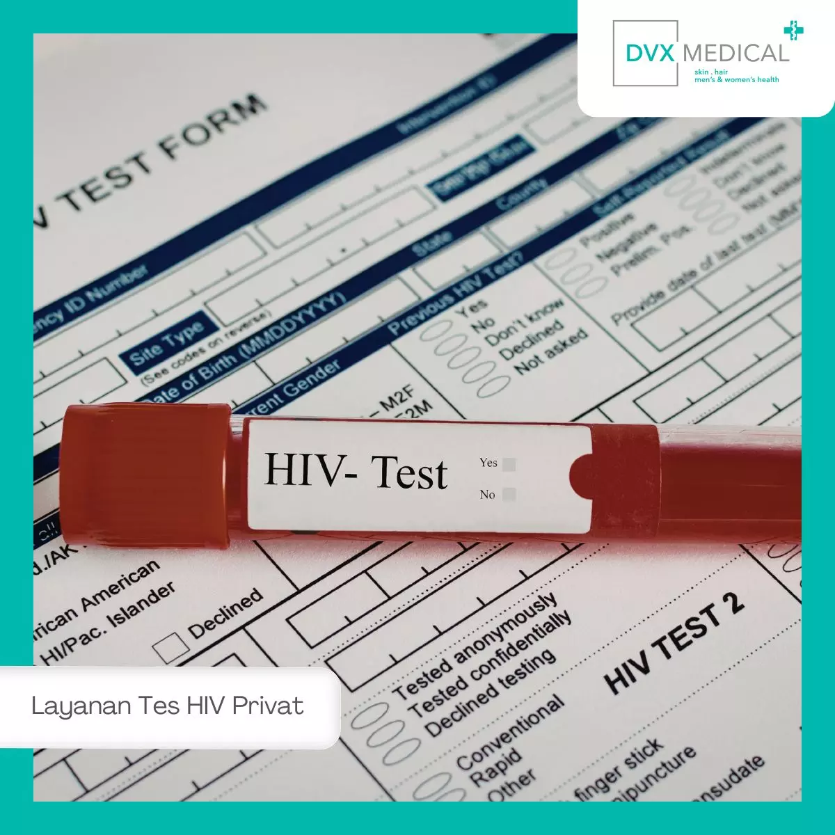 Mengapa Orang Menunda-nunda Melakukan Tes HIV?