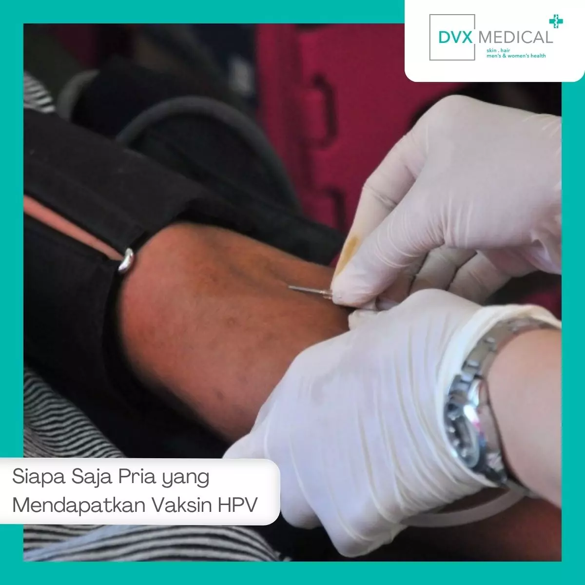 Siapa Saja Pria yang Dianjurkan Mendapatkan Vaksin HPV