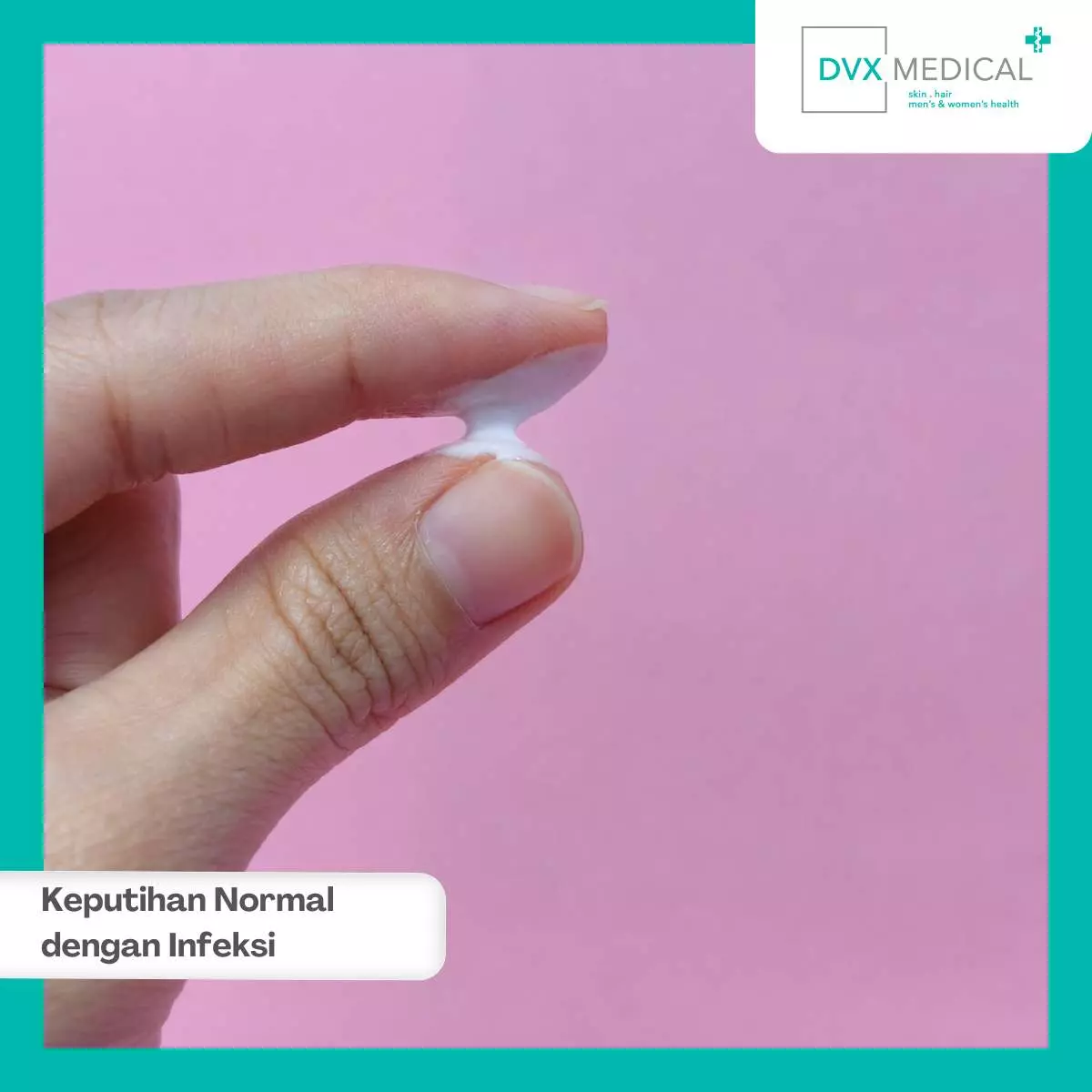 Apa Itu Keputihan?