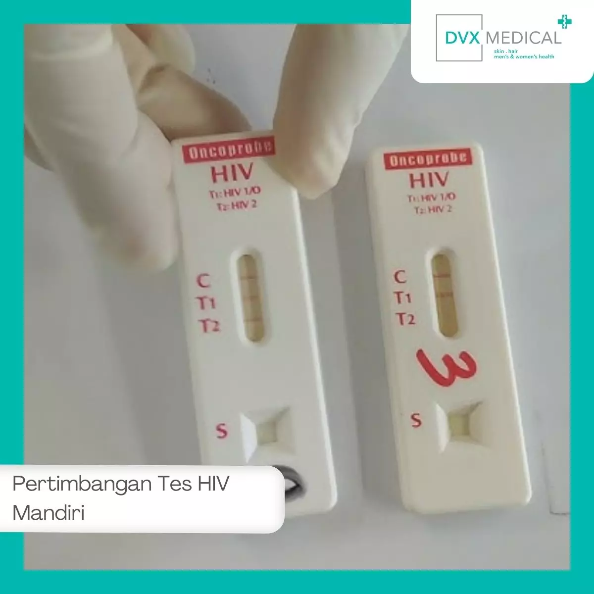 Risiko Tes HIV Mandiri yang Perlu Dipertimbangkan 