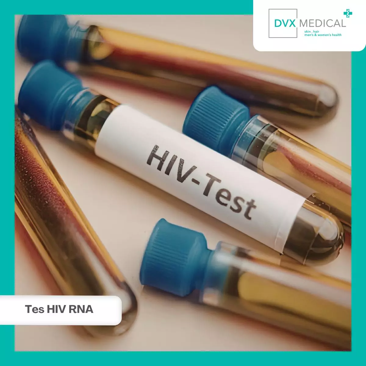 Apa Itu Tes HIV RNA?