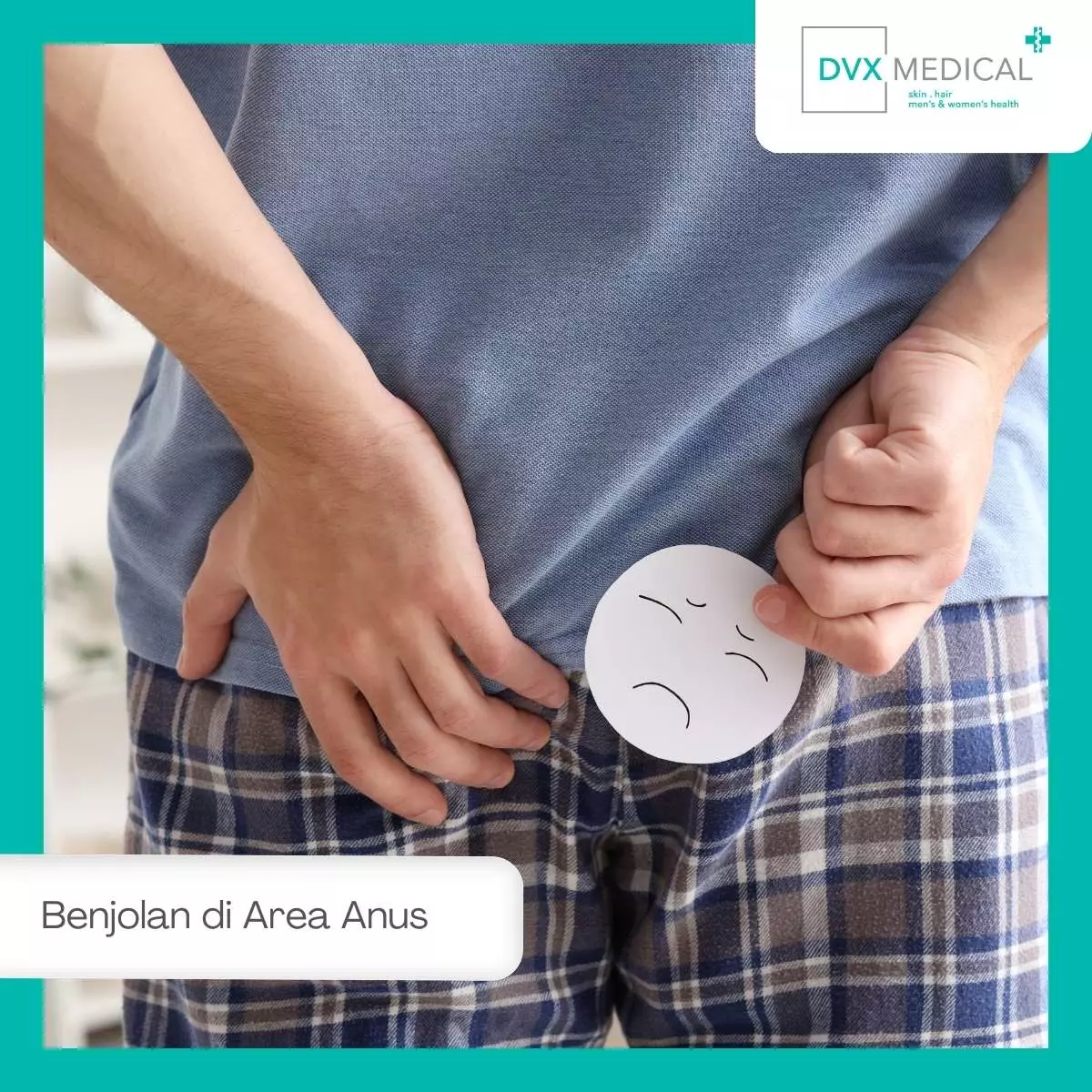 Penyebab Benjolan di Area Anus yang Paling Umum