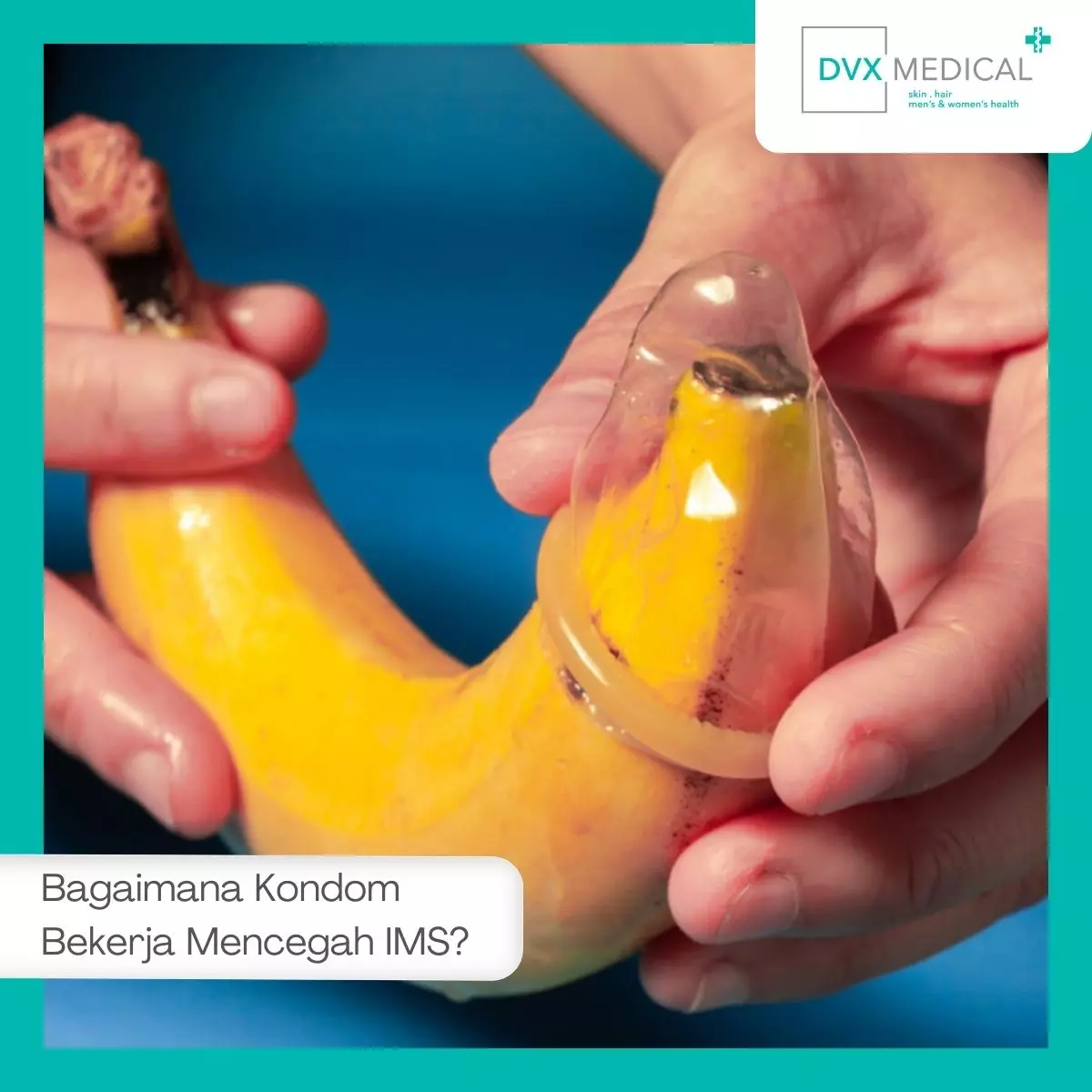 Bagaimana Kondom Bekerja Mencegah IMS?