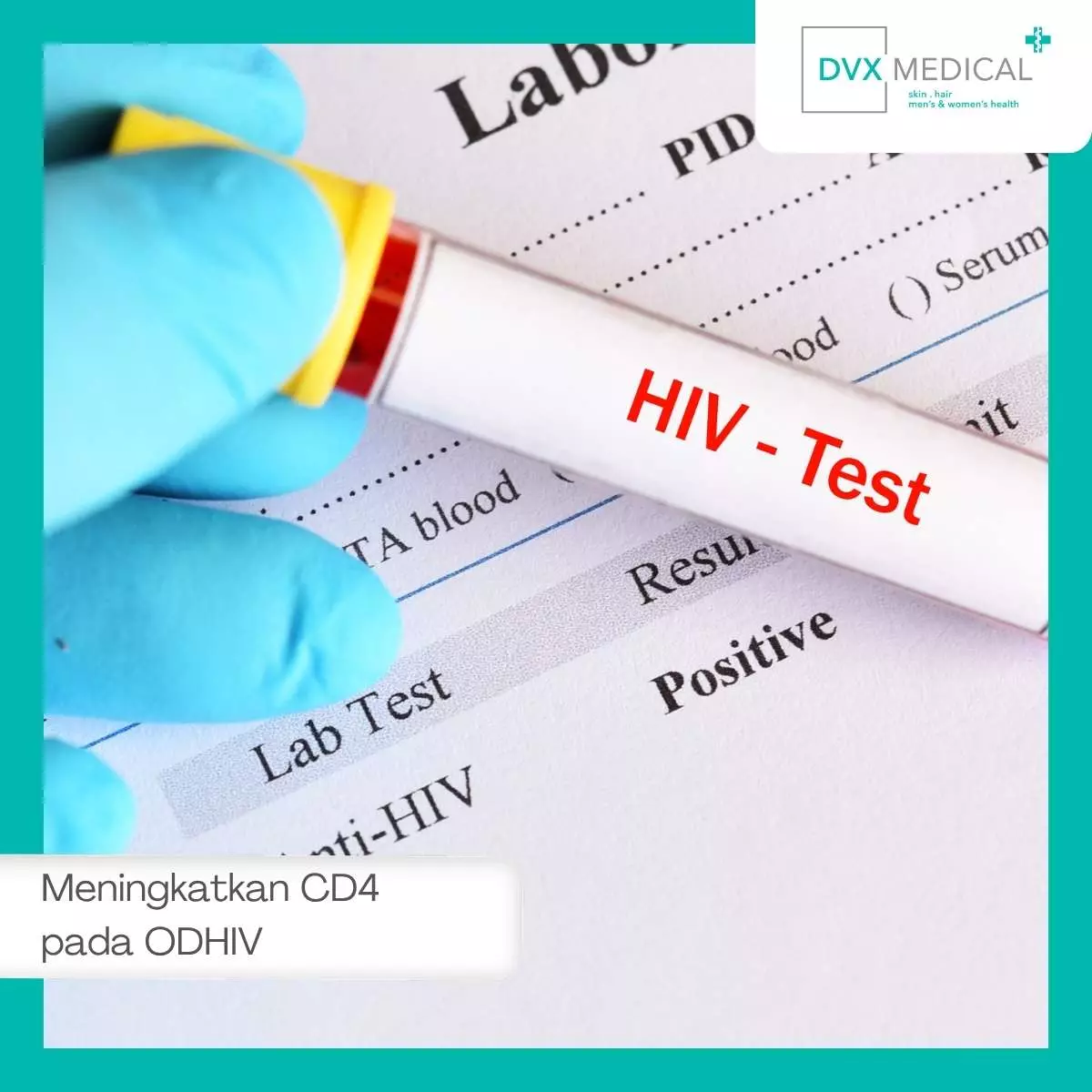 Tips Meningkatkan CD4 Secara Alami melalui Gaya Hidup Sehat