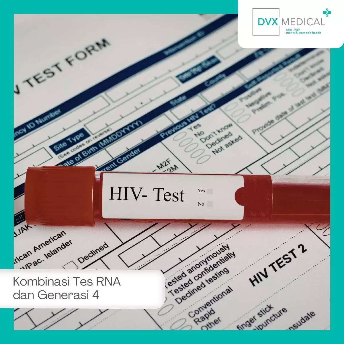 Kapan Perlu Melakukan Kombinasi Tes RNA HIV dan Generasi 4? 