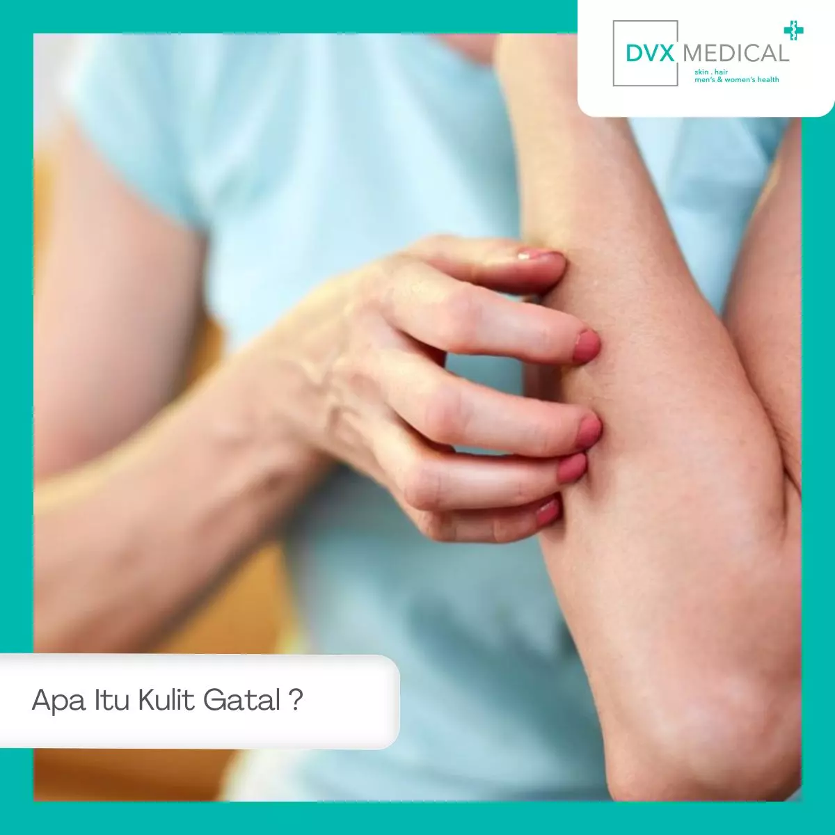 Apa Itu Kulit Gatal yang Tidak Kunjung Sembuh?