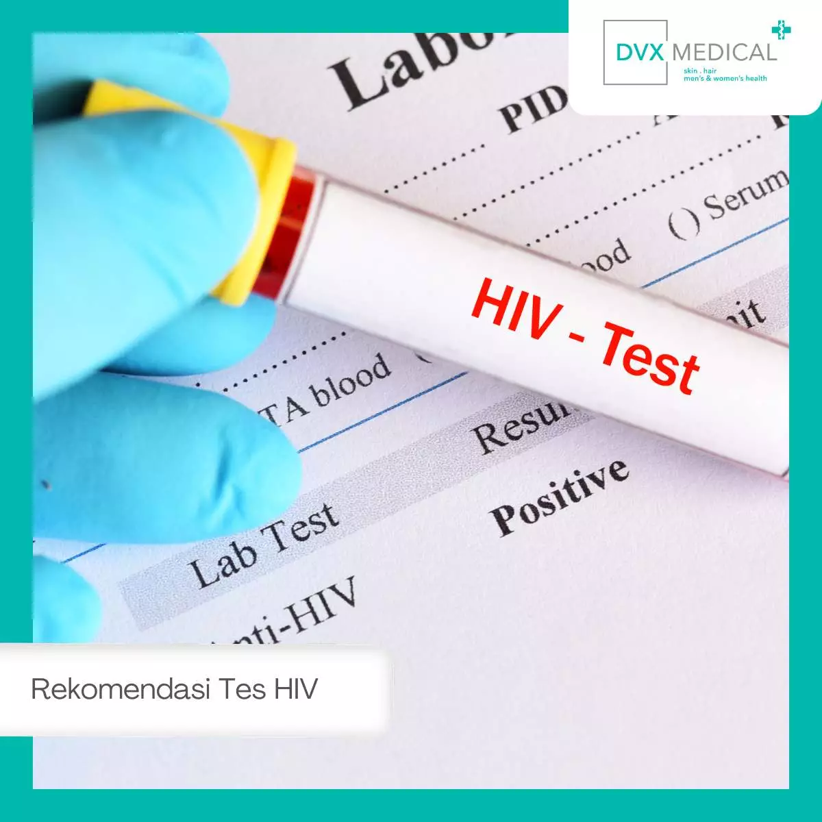 Pentingnya Tes HIV di Fasilitas Medis Terpercaya