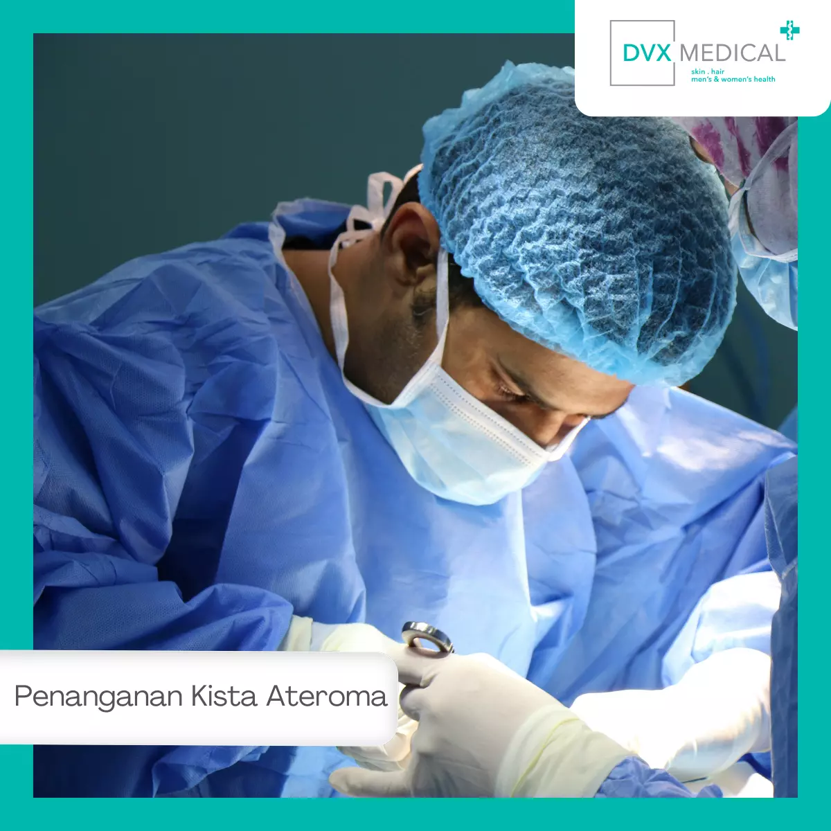 Pilihan Penanganan Medis Kista Ateroma