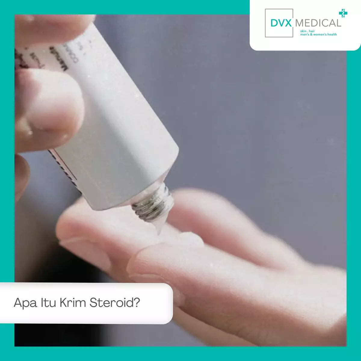 Apa Itu Krim Steroid?