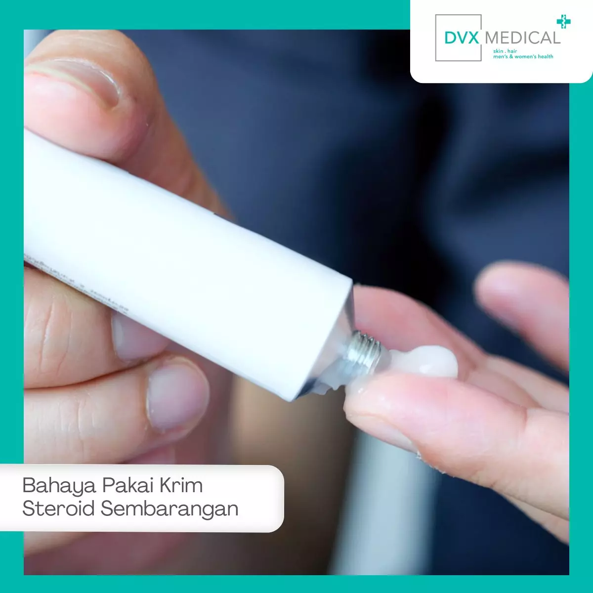 Mengapa Krim Steroid Tidak Boleh Digunakan Sembarangan?