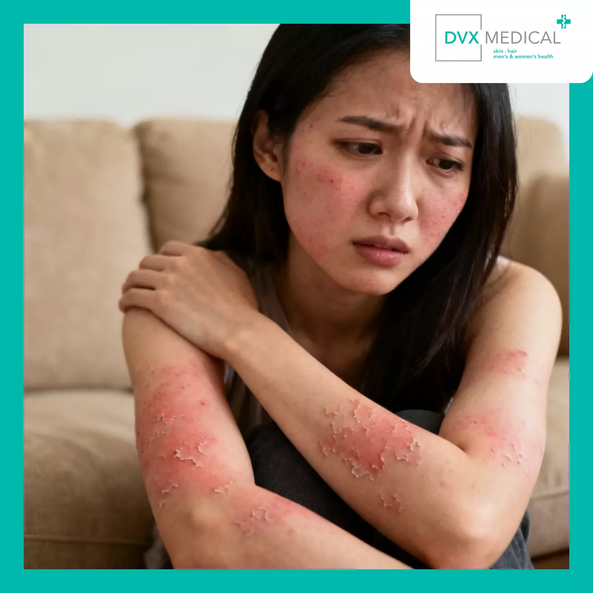 Siapa yang Secara Klinis Dipertimbangkan untuk Dupilumab (Dupixent&reg)