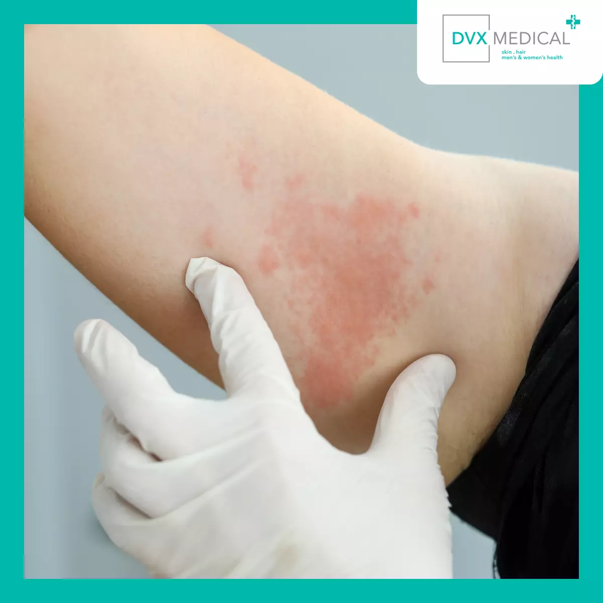 Mengapa Perbedaan Ini Penting?