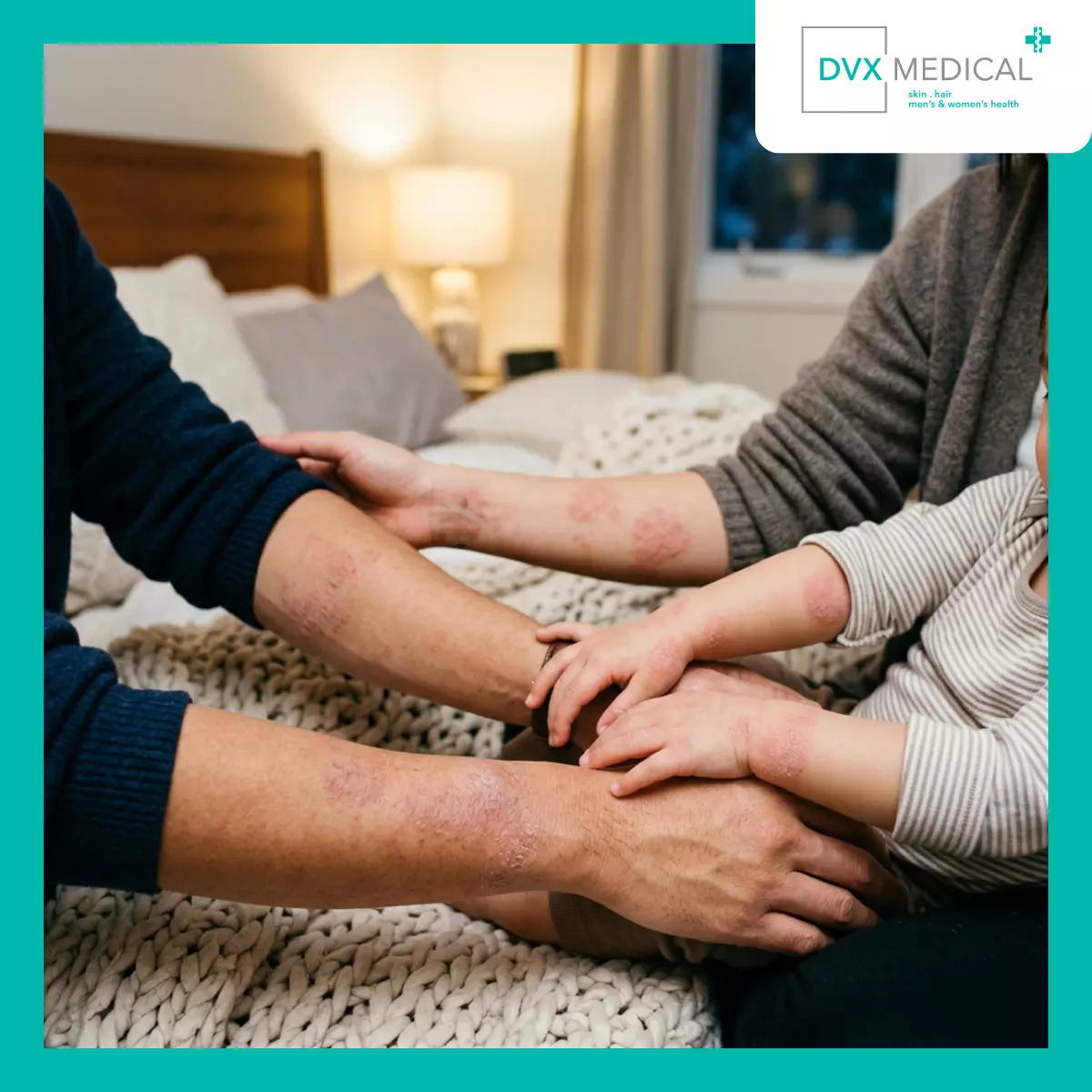 Mengapa Dermatitis Atopik Sering Muncul dalam Keluarga?