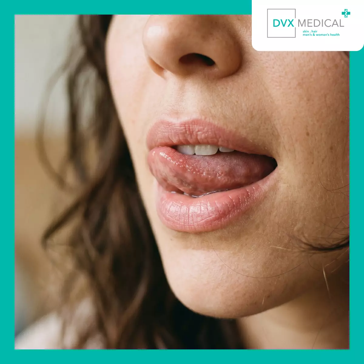 Mengapa Menjilat Bibir Justru Memperburuk Keadaan?