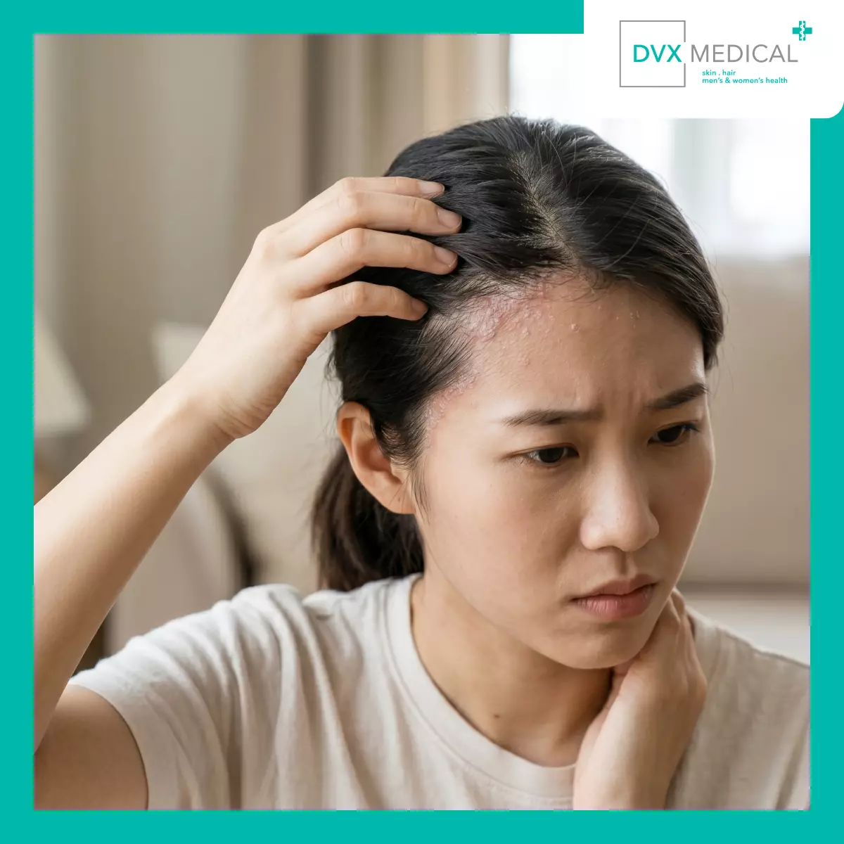 Mengapa Dermatitis Atopik Sering Muncul di Leher?