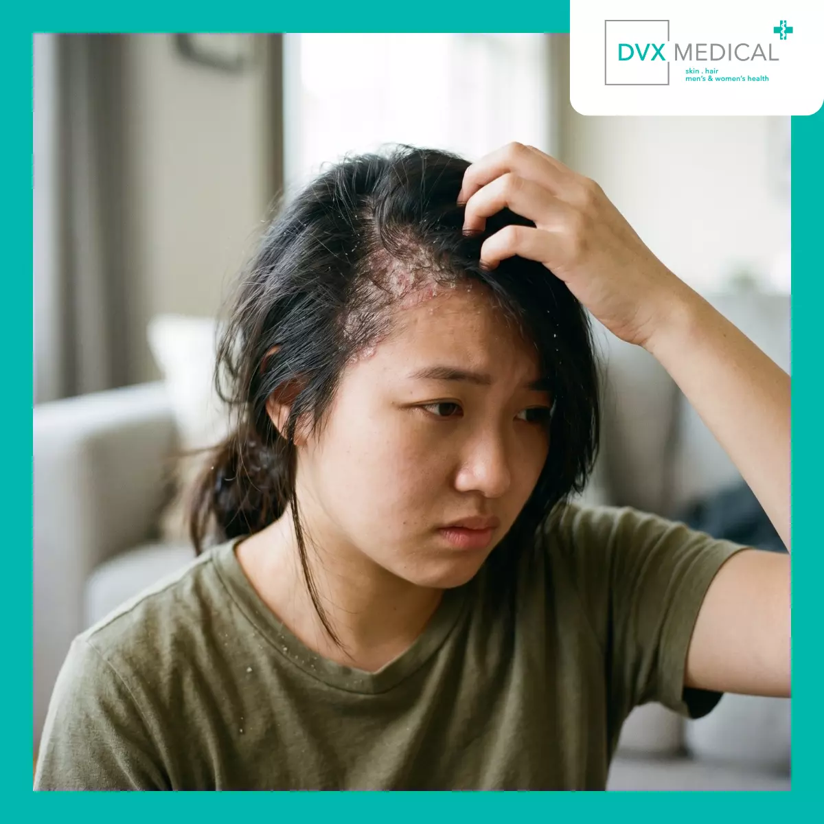 Apakah Semua Pasien Psoriasis Bisa Mendapatkan Terapi Biologik?