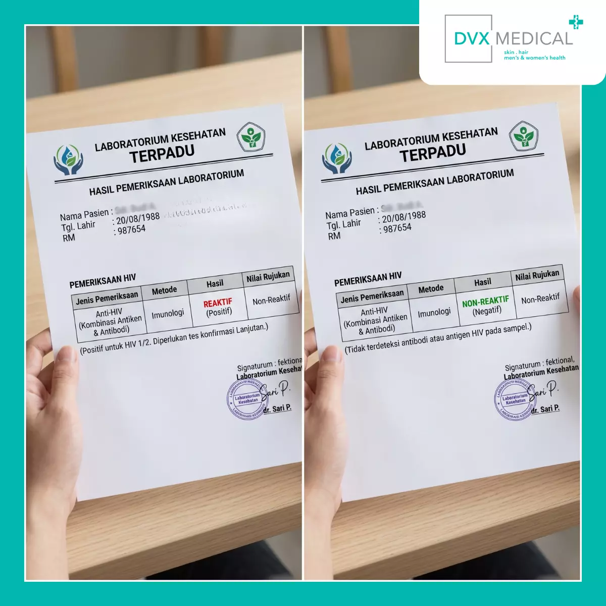 Bisakah Hasil Reaktif Merupakan False Positive?