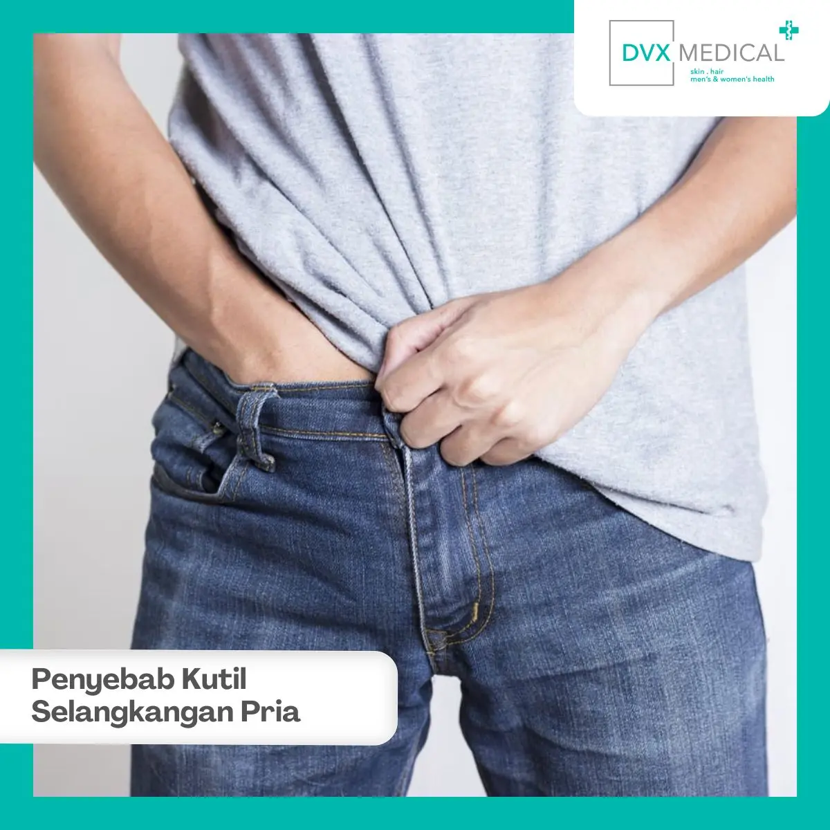 Apakah Semua Kutil di Selangkangan Pria Disebabkan HPV?