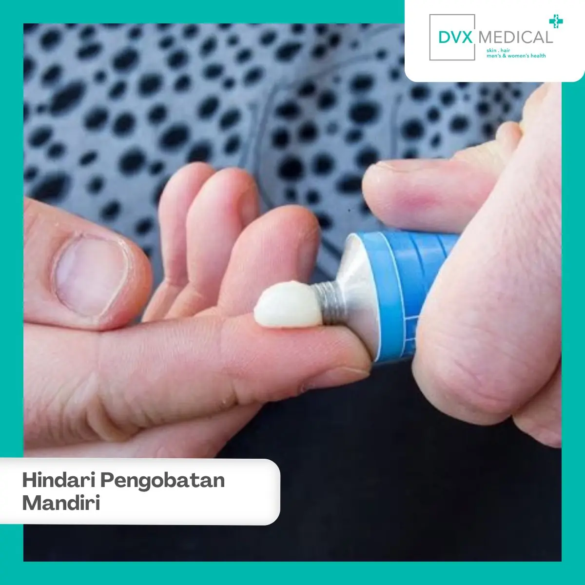Hindari Mengobati Benjolan Selangkangan Secara Mandiri