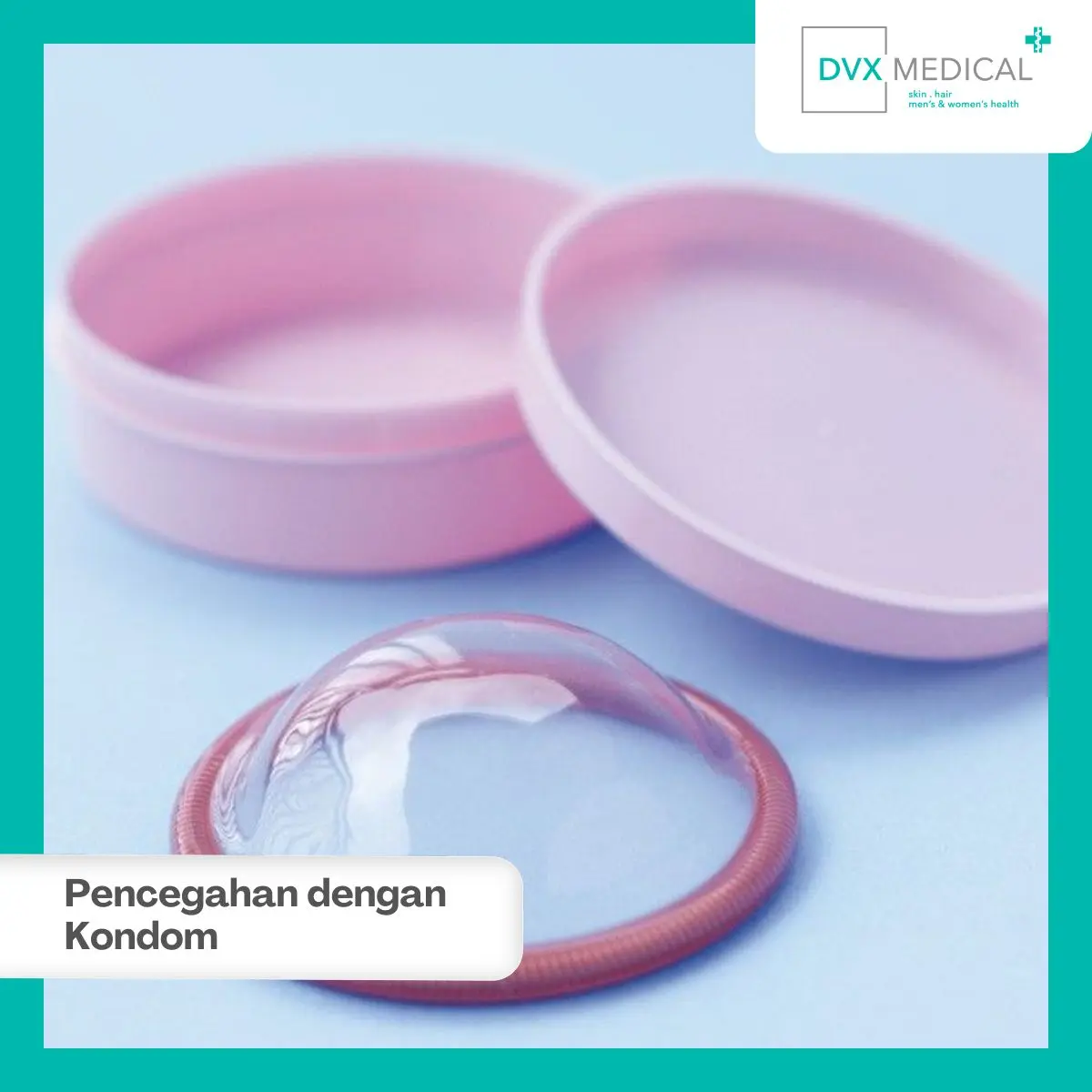Apakah Kondom Bisa Mencegah Penularan?