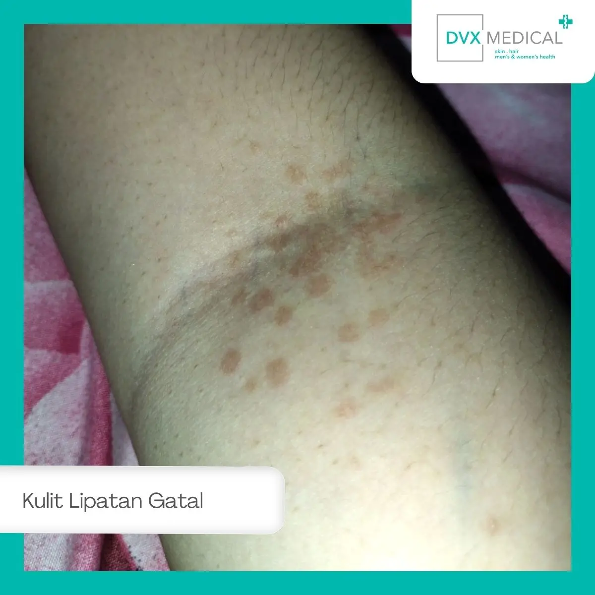 Mengapa Seseorang Bisa Ragu Datang ke Klinik Kulit dan Kelamin?
