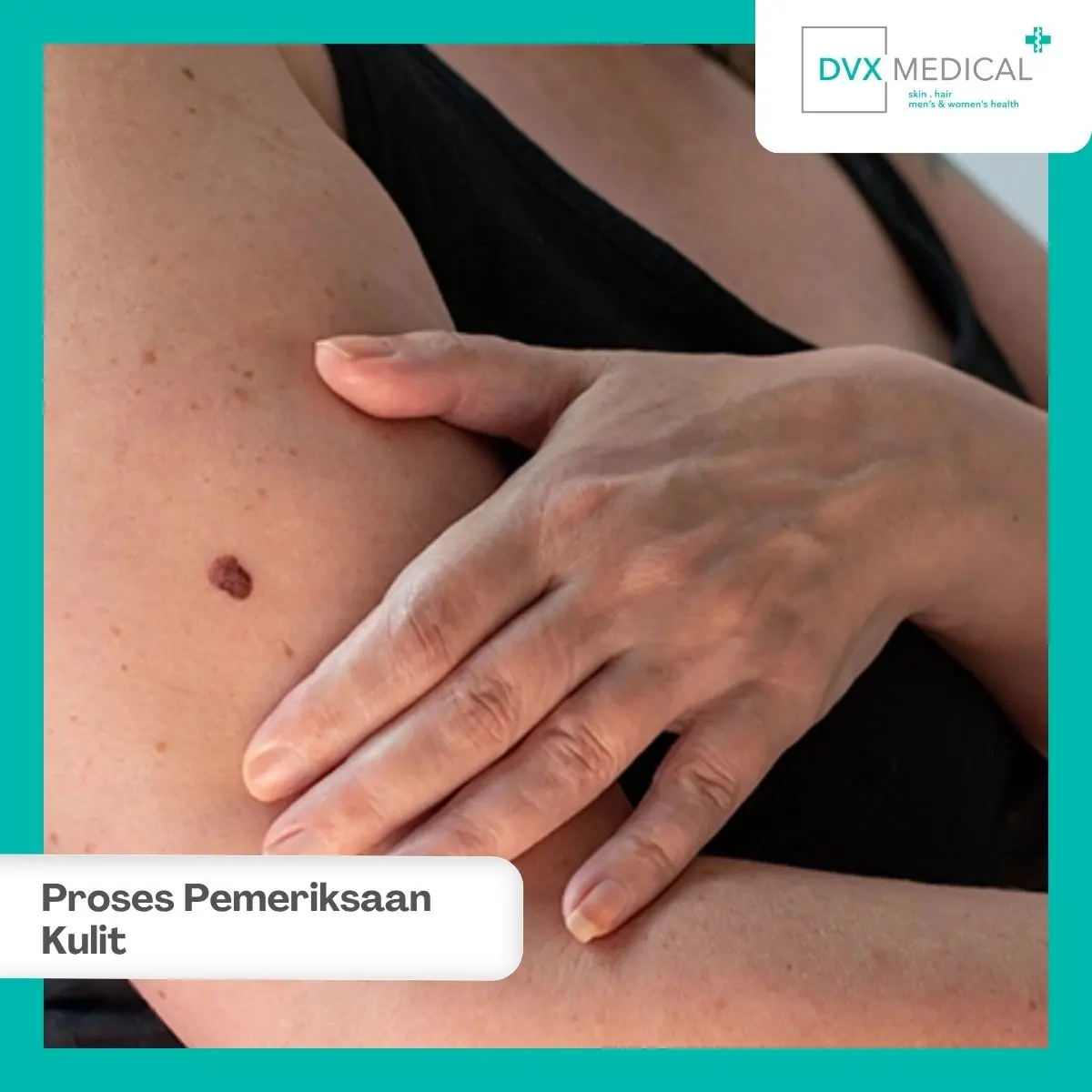 Apa yang Dilakukan Dokter Saat Memeriksa Keluhan Kulit?