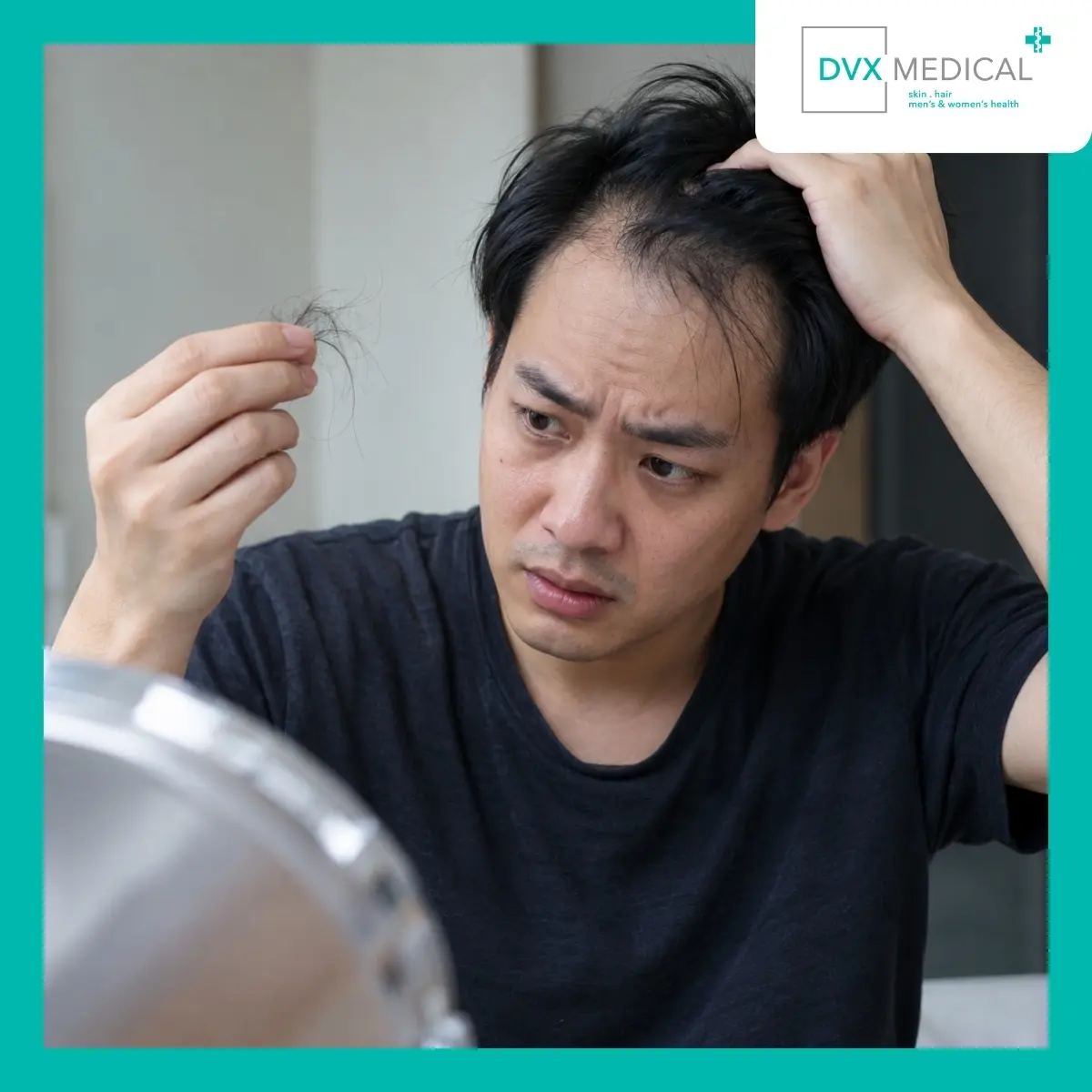 Apakah Alopecia Areata Dapat Sembuh?