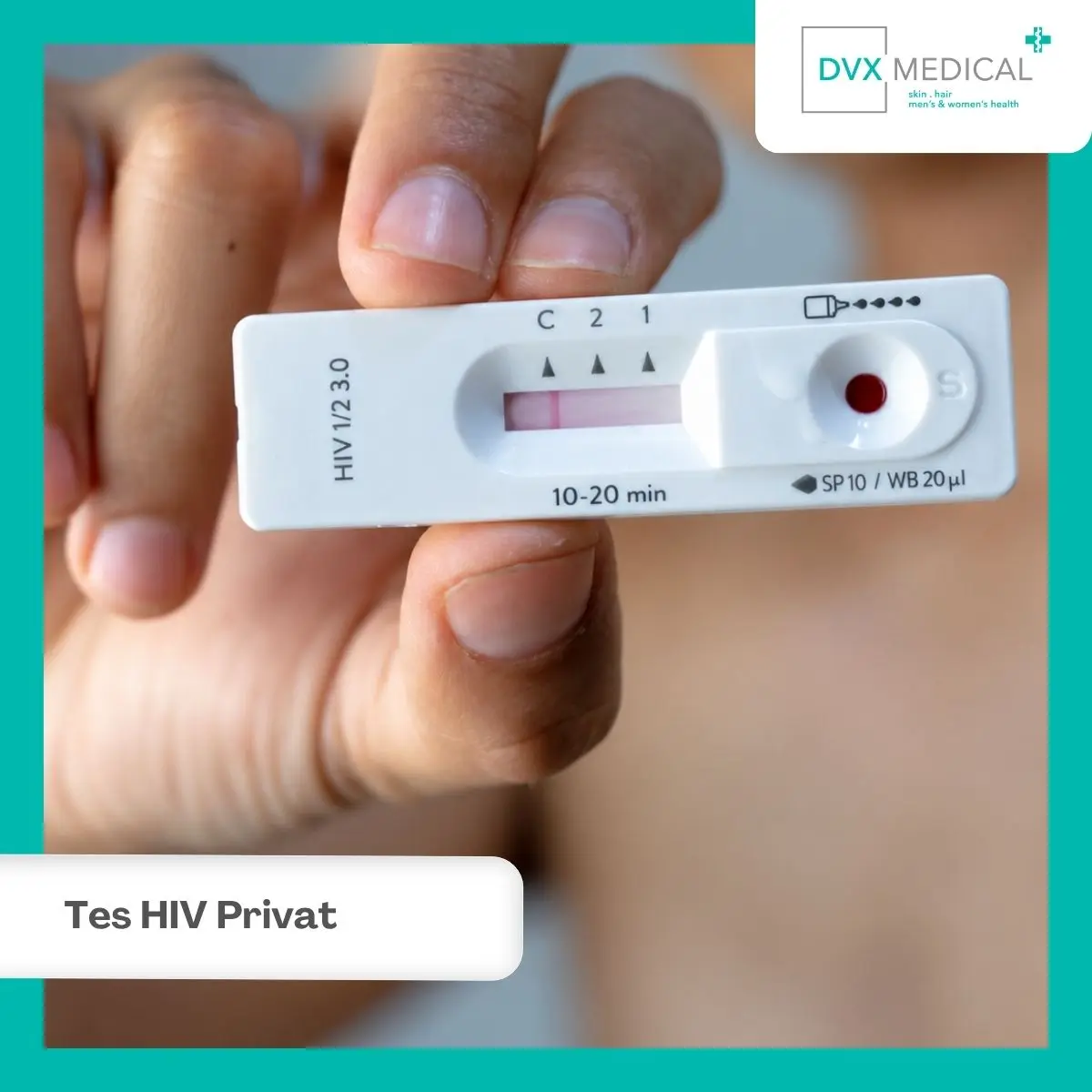 Tes HIV Privat di DVX Medical Jakarta