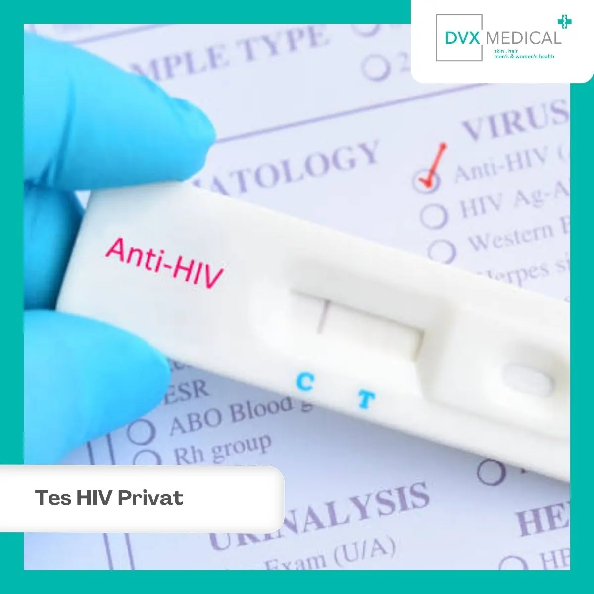 Tes HIV Privat di DVX Medical Jakarta