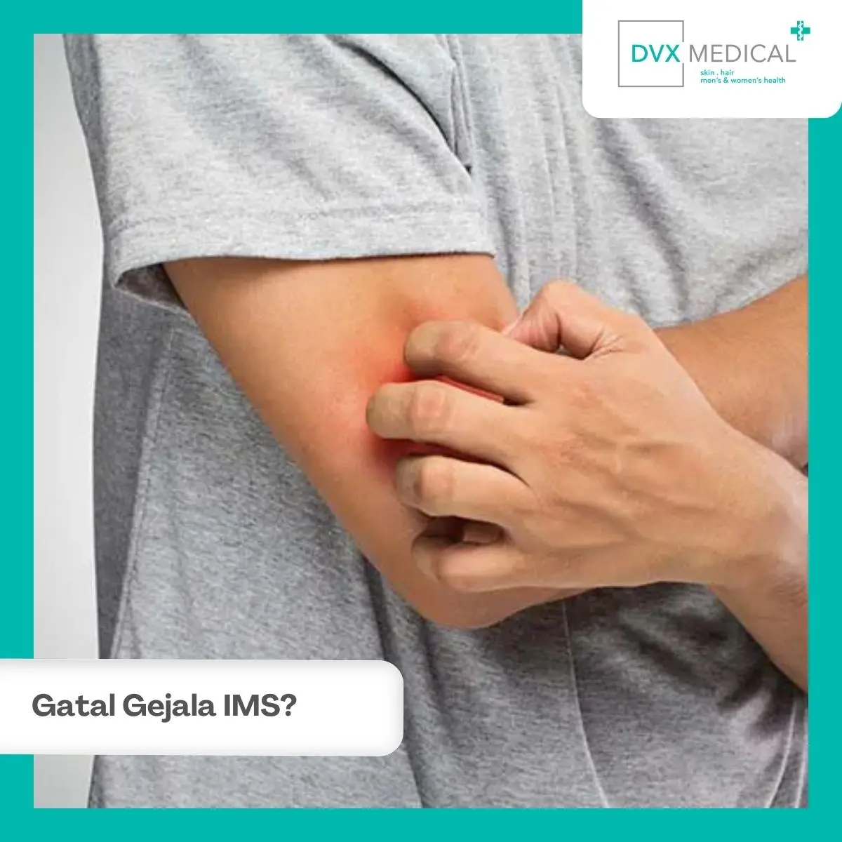 Apakah Gatal di Kelamin Setelah Berhubungan Bisa Menjadi Gejala IMS?