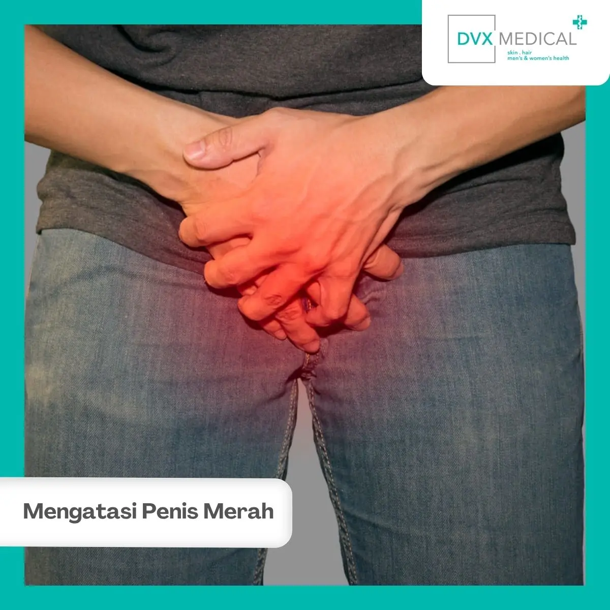 Apa yang Sebaiknya Dilakukan Saat Kepala Penis Merah?