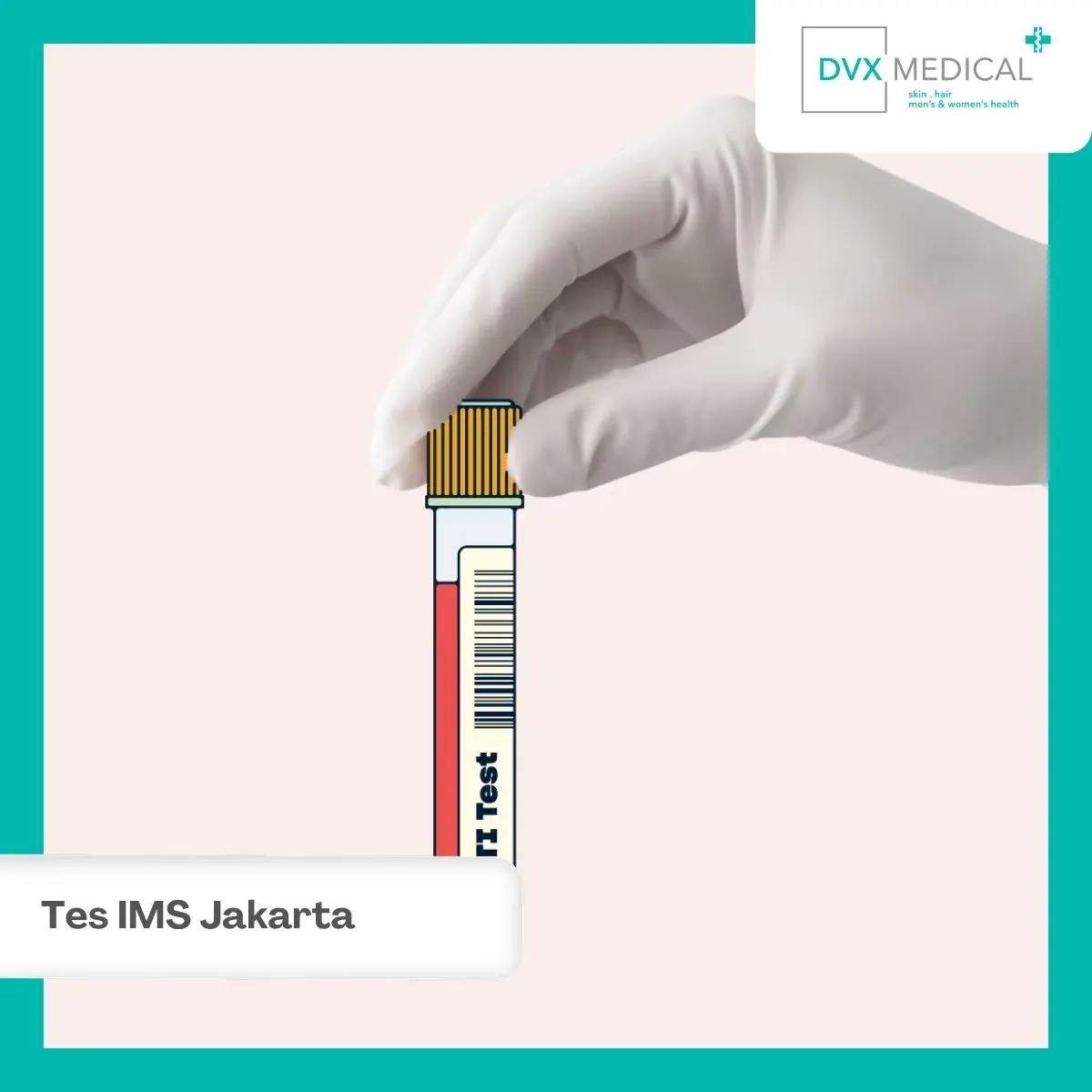 Tes IMS di DVX Medical Jakarta