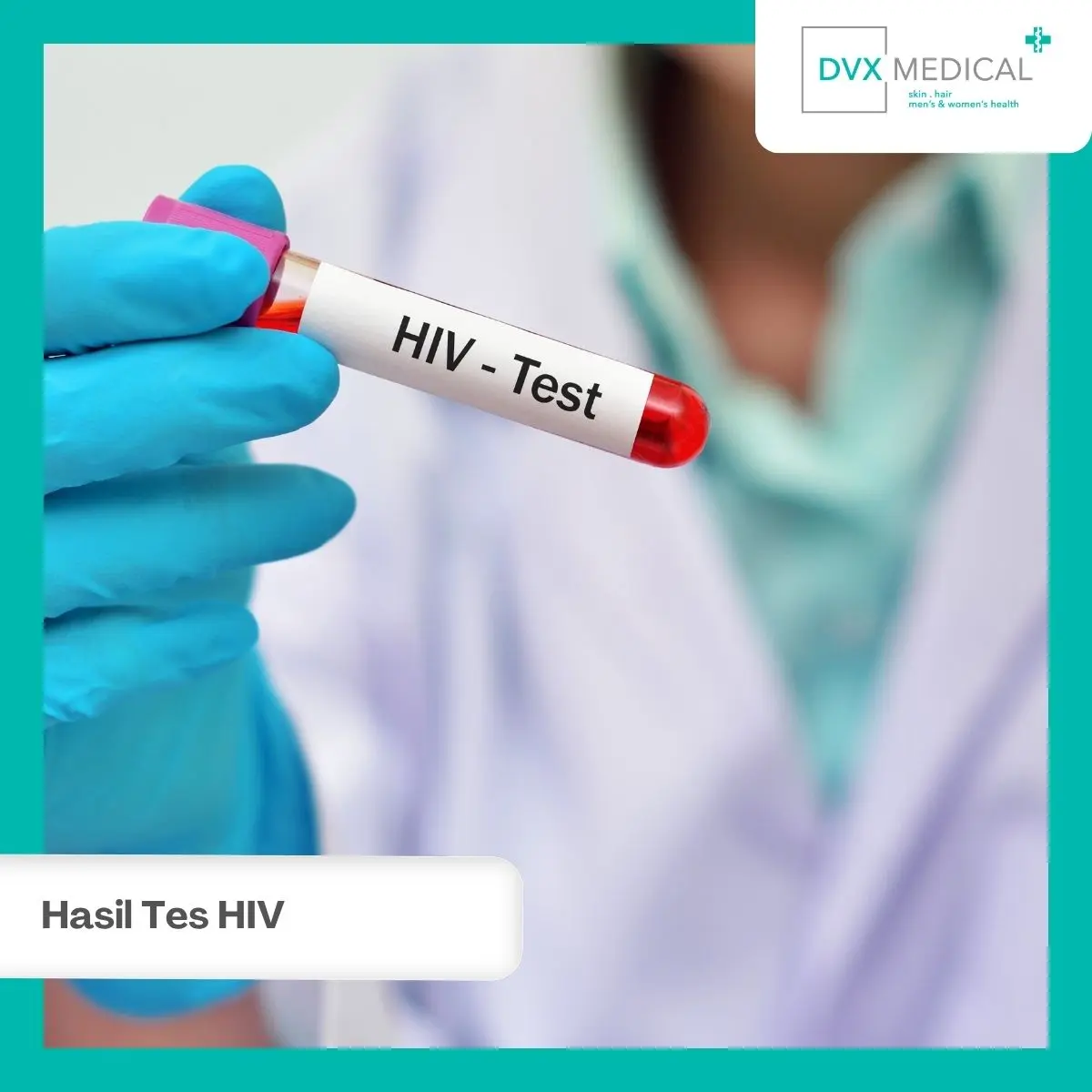 Mengapa Hasil Tes HIV Sebaiknya Dibaca Bersama Tenaga Medis?
