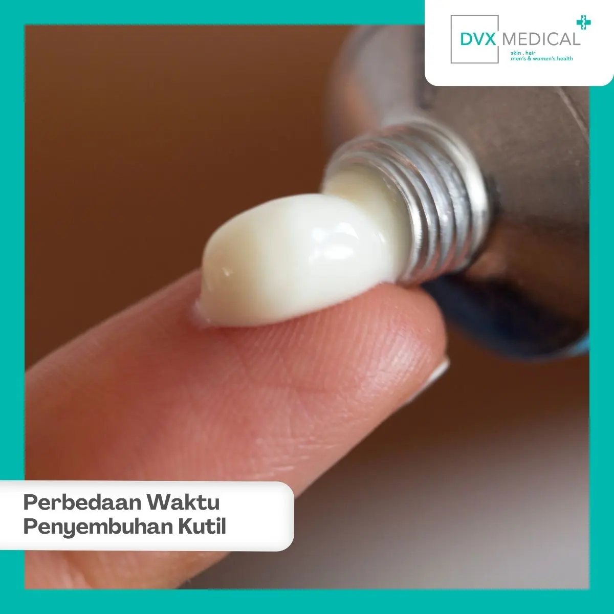 Berapa Lama Waktu Penyembuhan Kutil Kelamin Secara Umum?