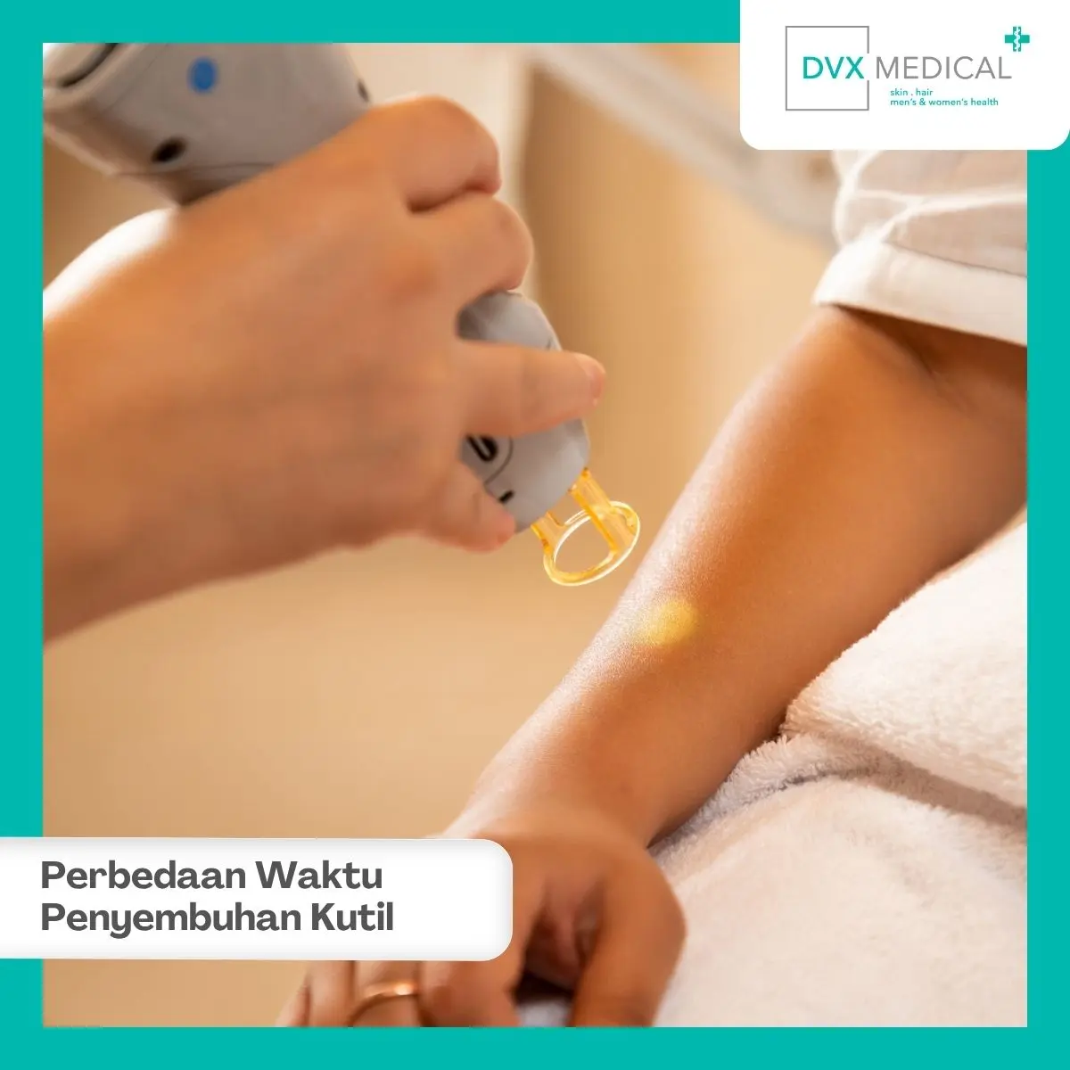 Kutil Sudah Hilang, Apakah Berarti HPV Juga Sudah Sembuh?