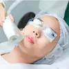 Laser