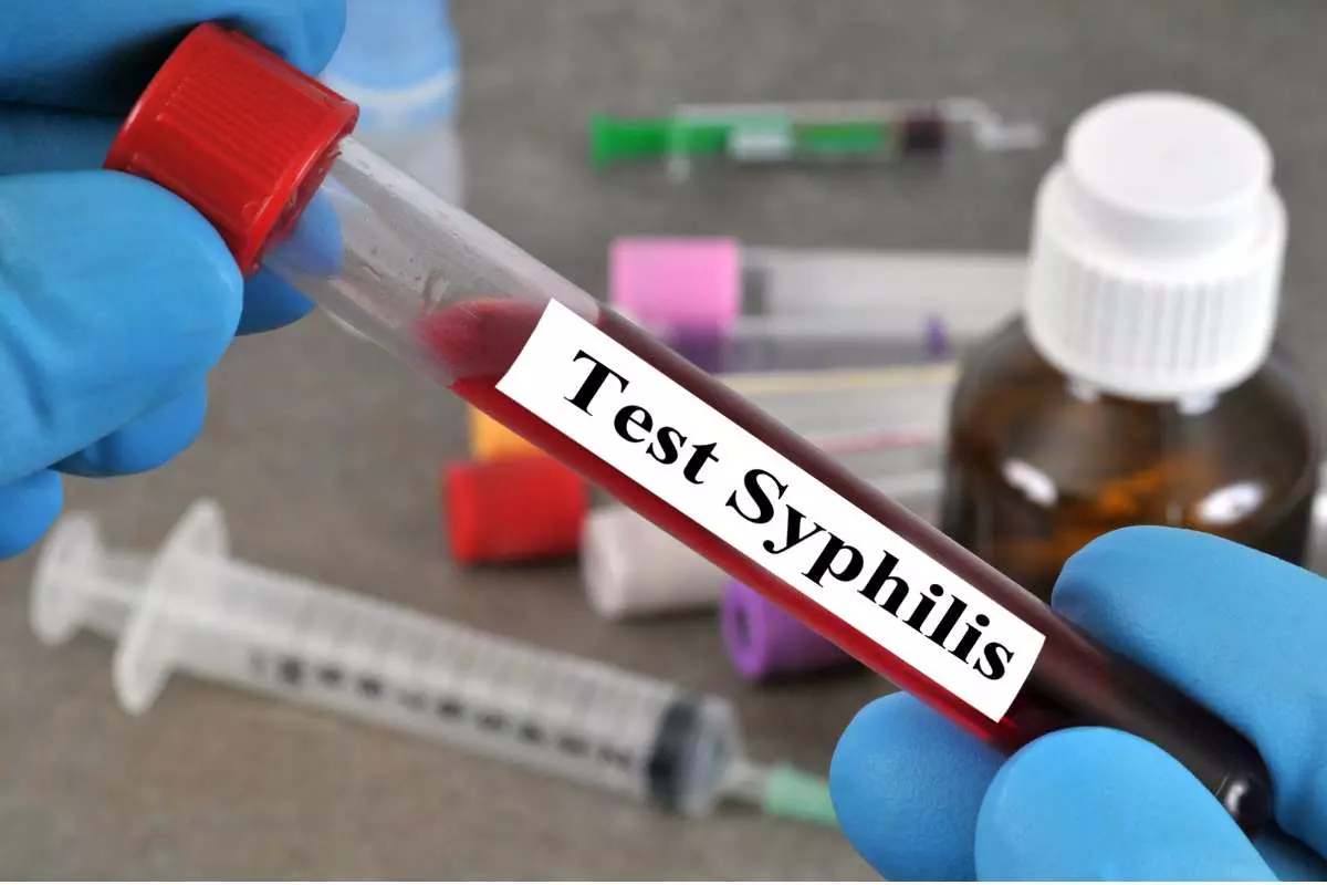Pemeriksaan Sifilis dan HIV di DVX Medical Surabaya